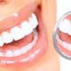 reabilitacao-oral-orthoclinica-dentista-sbc-abc
