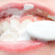 dicas-para-melhorar-o-resultado-da-escovacao-dos-dentes
